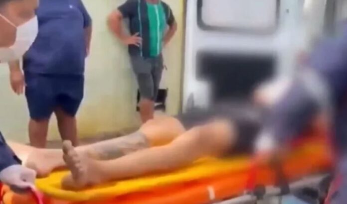 Vítima se defende e acerta tiro no queixo de assaltante durante tentativa de roubo em loja