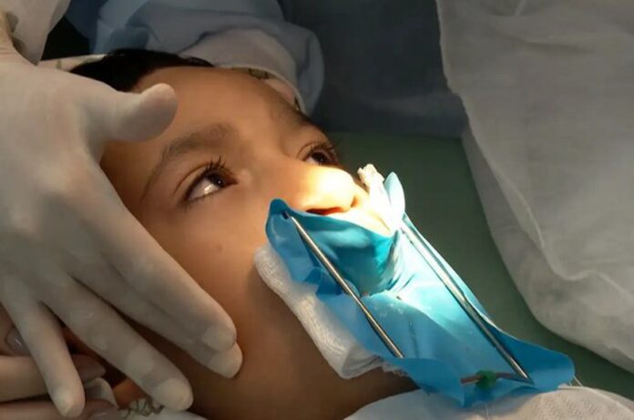 Lei sancionada garante cirurgia de lábio leporino e tratamento integral pelo SUS