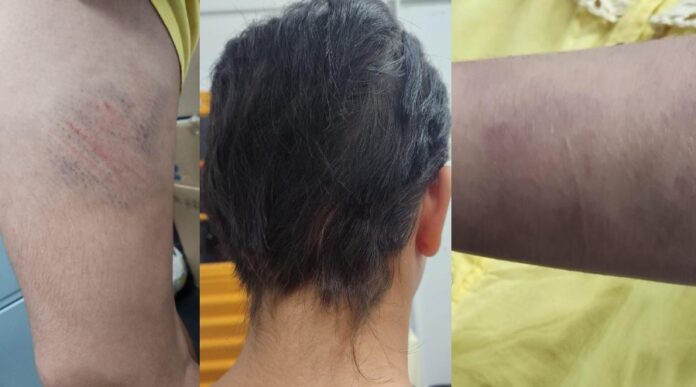 Mãe detida por agredir e mutilar o cabelo da filha de 13 anos em Manaus