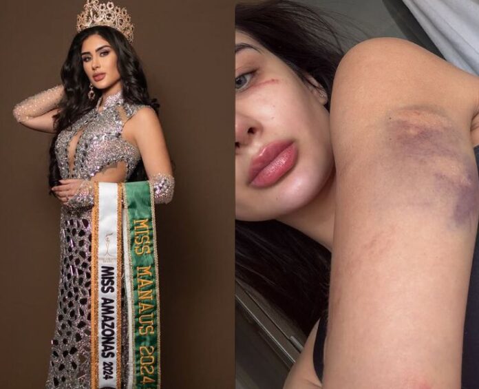 Miss Grand Amazonas Revela Agressões e Ameaças de Morte por Parte do Ex-Namorado