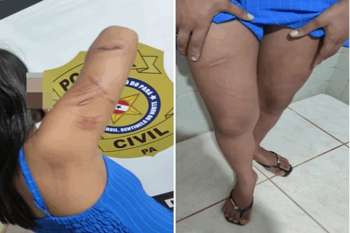 Adolescente é torturada por facção após ser acusada de ‘X9’