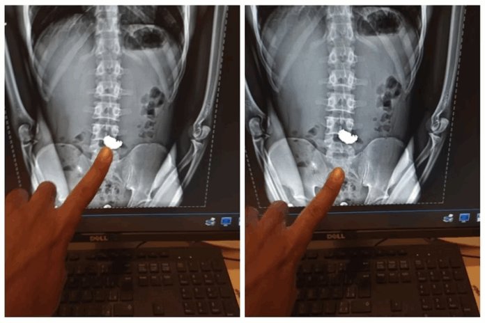Homem engole corrente de ouro para escapar de flagrante