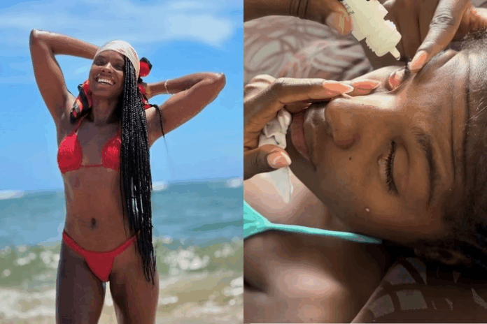 Modelo Ivana Souza fica cega temporariamente após pomada atingir os olhos
