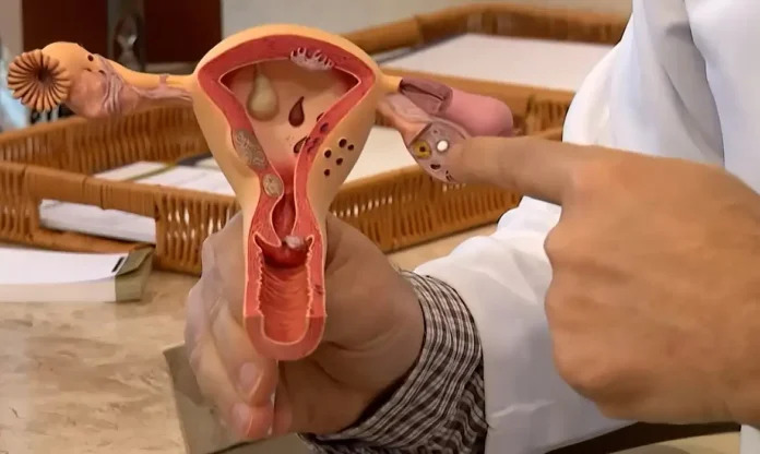 Endometriose: Sintomas e Tratamentos Essenciais para a Saúde Feminina