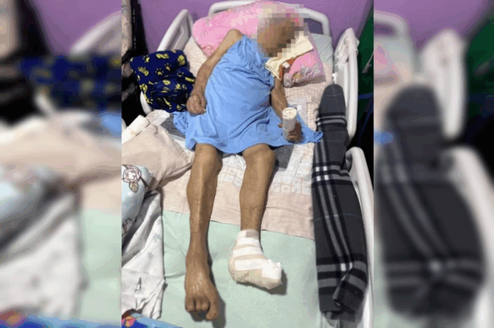 Notícias do Amazonas – Idosa de 103 anos sofre amputação brutal sem anestesia