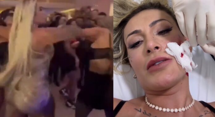 Notícias do Amazonas – Andressa Urach se machuca em briga com Juju Ferrari em festa