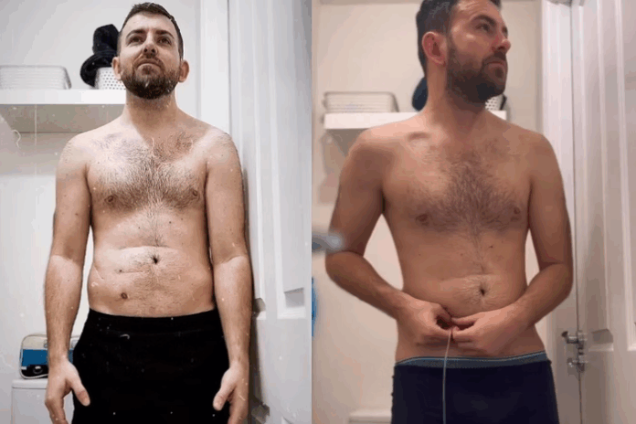 Homem que nasceu sem ânus compartilha rotina na internet