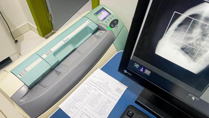 Notícias do Amazonas – Sindicato alerta sobre possível vazamento de radiação em hospitais do Acre