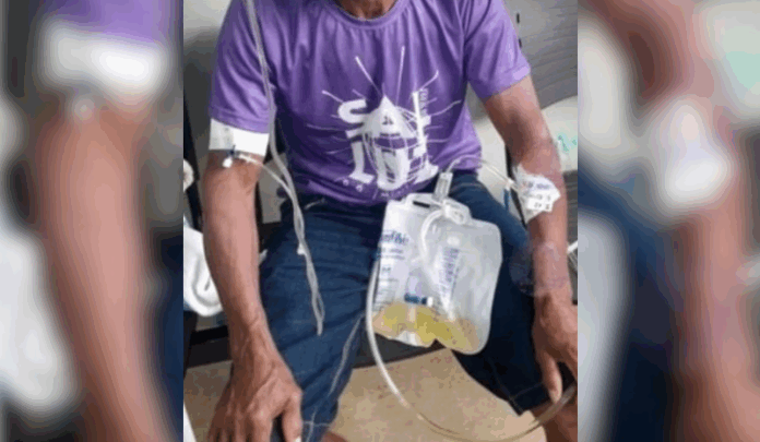 Notícias do Amazonas – Agricultor de 50 anos é ferido por raio em sua residência