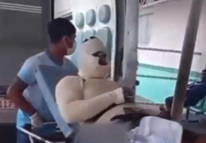 VÍDEO: Explosão em usina deixa trabalhador com queimaduras graves em Itacoatiara