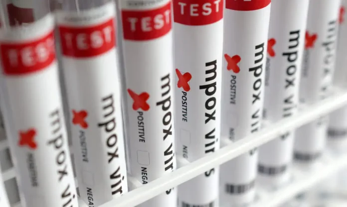 Mpox: Acnur solicita US$ 21,4 milhões para ajudar refugiados na África