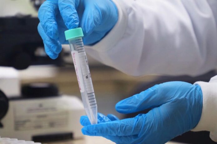 Notícias do Amazonas – Cenário de mpox se mantém estável com medidas preventivas