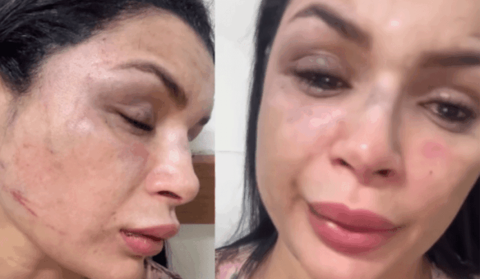 Notícias do Amazonas – Musa da Aparecida não identifica motorista agressor em depoimento